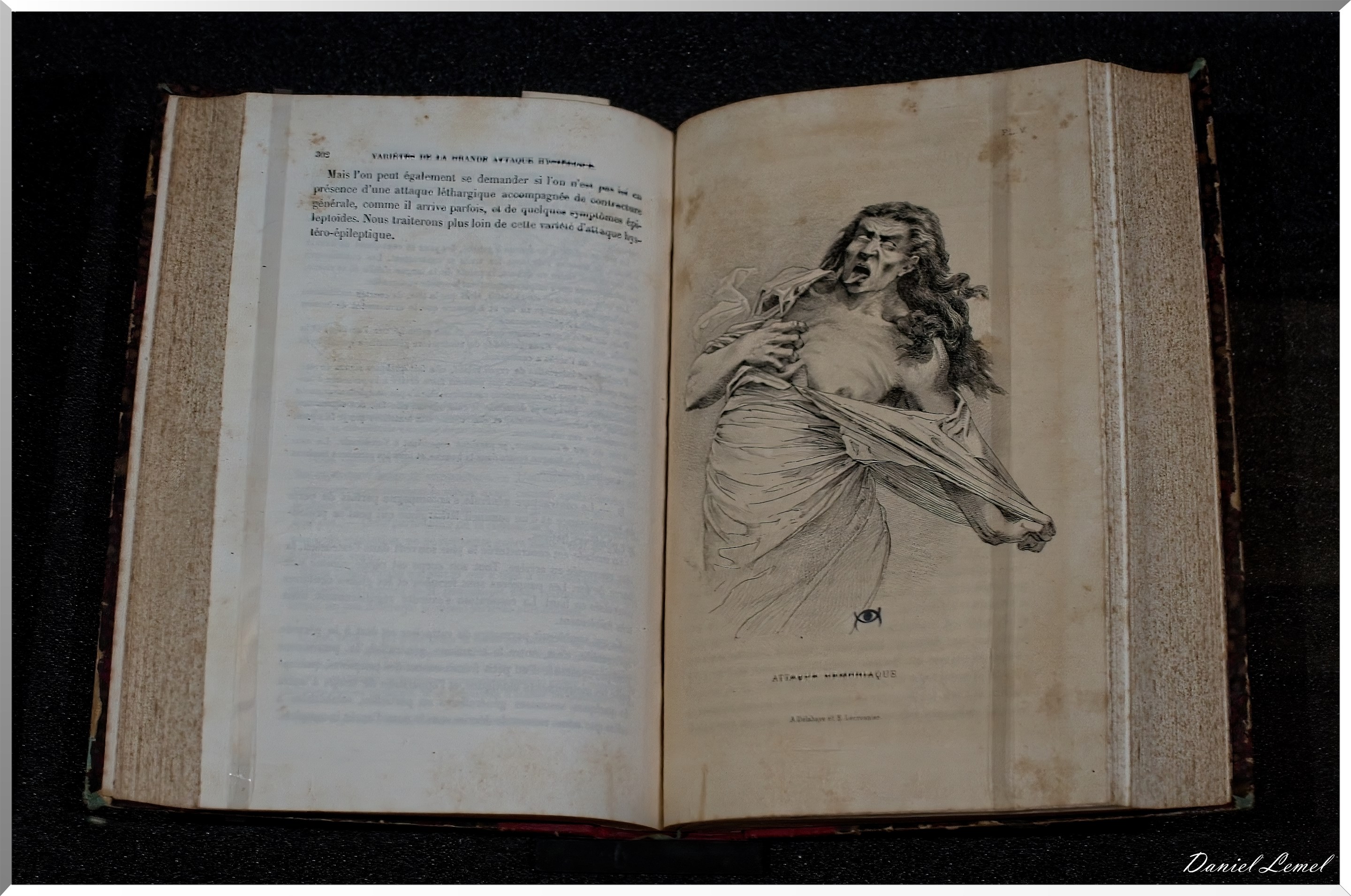 Histoire de sorcellerie